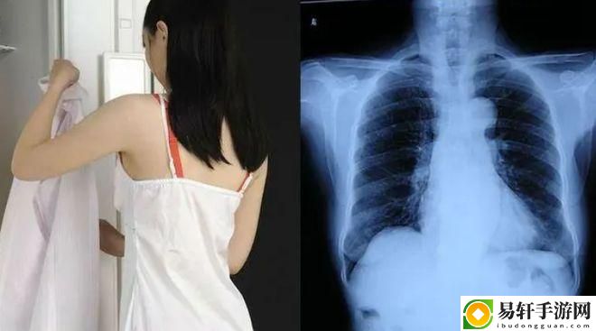 探索“100%胸片曝光率图片女生”的文化与影响