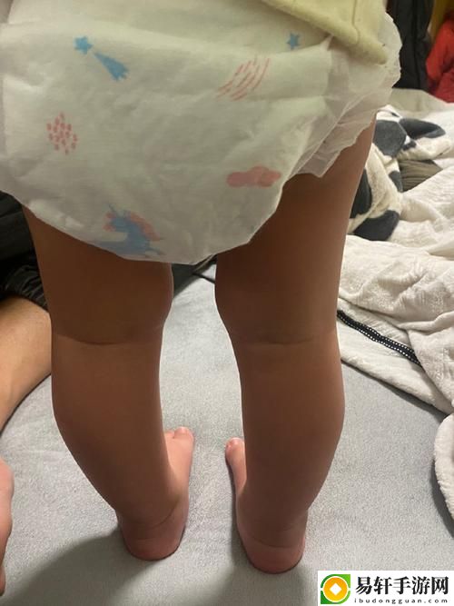 宝贝腿张大点就不疼了，网友分享：如何缓解腿部不适的实用技巧
